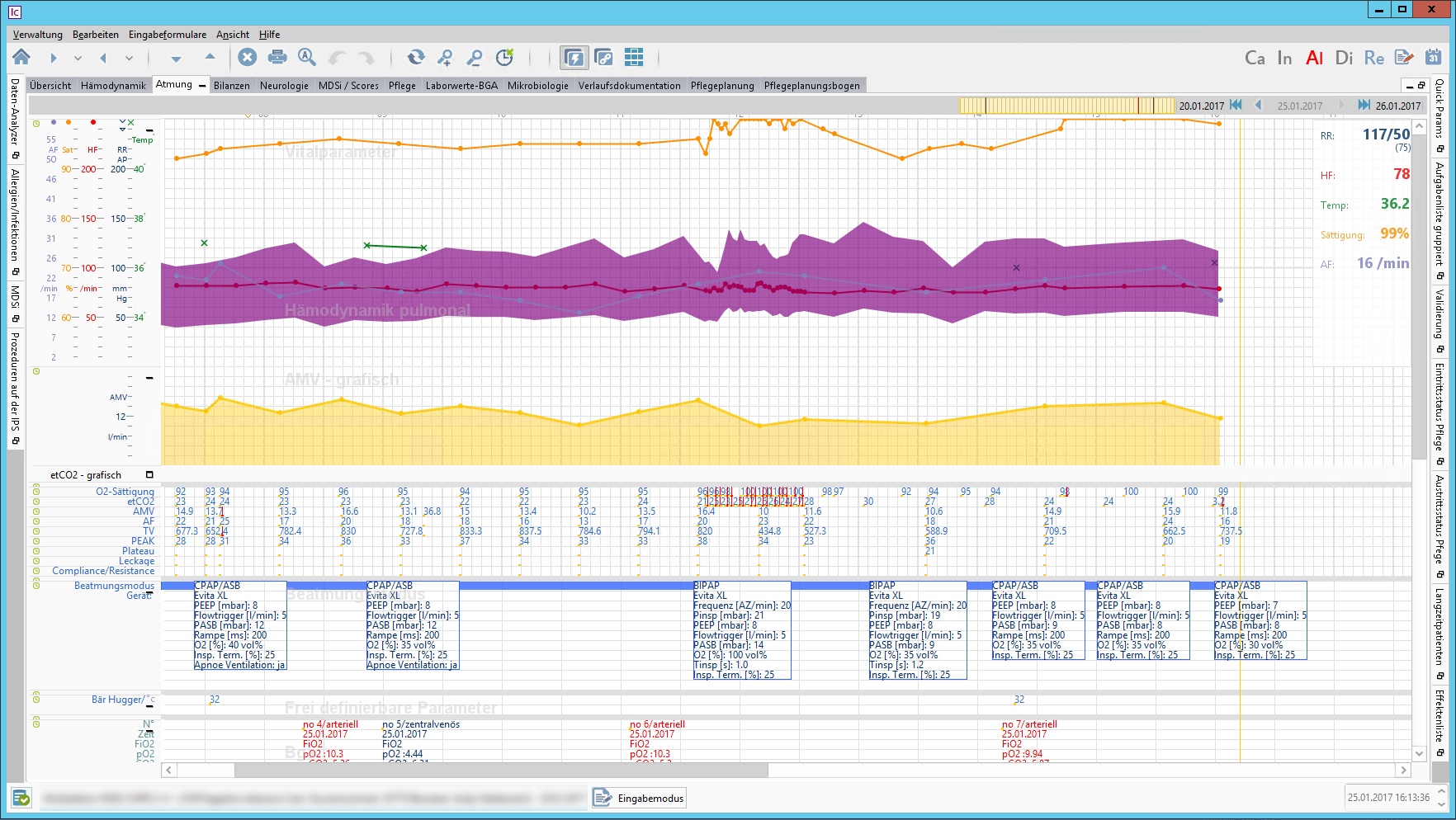 Intensivkurve mit Darstellung der Verlaufsdaten für Kreislauf, Beatmung und Blutgasanalysen.